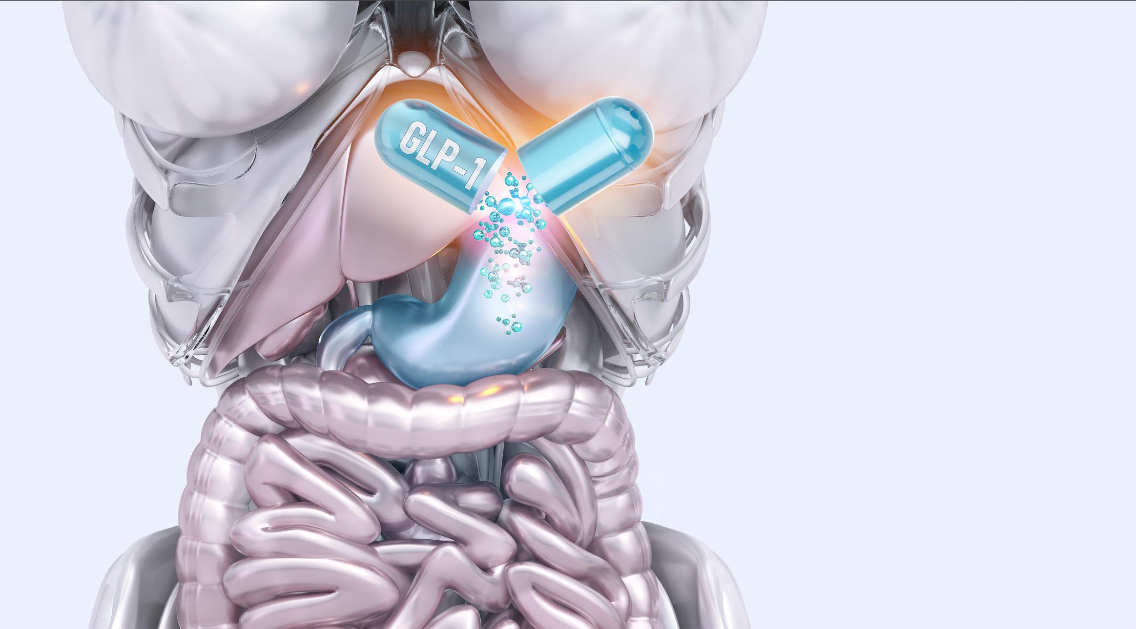 Medisch Afvallen met GLP-1 / GIP Medicatie vs Maagverkleining